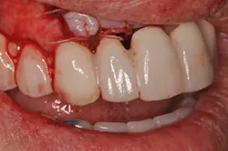 14jul10srrsaliernoflipper07 14jul10srrsaliernoflipper07