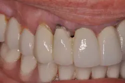 14jul10srrsaliernoflipper08 14jul10srrsaliernoflipper08