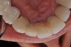 14jul10srrsaliernoflipper09 14jul10srrsaliernoflipper09