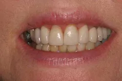 14jul24srrbearapicposflap02 14jul24srrbearapicposflap02