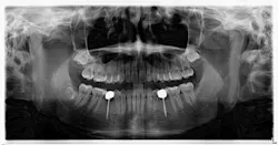 14jun12srrsimmonspumpkin01 14jun12srrsimmonspumpkin01