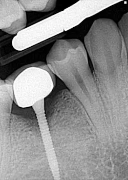 14jun12srrsimmonspumpkin03 14jun12srrsimmonspumpkin03