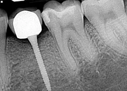 14jun12srrsimmonspumpkin04 14jun12srrsimmonspumpkin04