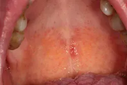 15may28srrfroum03 15may28srrfroum03