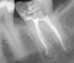 15oct15pia Mann05 15oct15pia Mann05