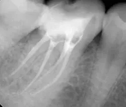 15oct15pia Mann08 15oct15pia Mann08