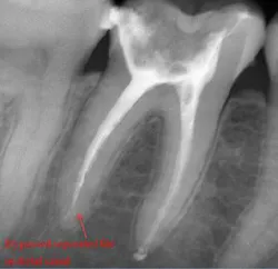 15oct15pia Mann11 15oct15pia Mann11