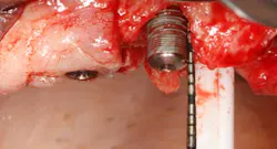 Apr112013 Froum Fig1 Apr112013 Froum Fig1