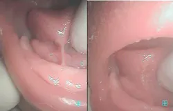 Koblercase1 Koblercase1