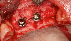 14oct23srrmannfroum13 14oct23srrmannfroum13