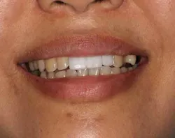 14oct23srrmannfroum15 14oct23srrmannfroum15