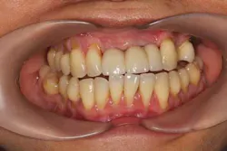 14oct23srrmannfroum18a 14oct23srrmannfroum18a