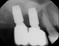 16apr21piafroum01b 16apr21piafroum01b