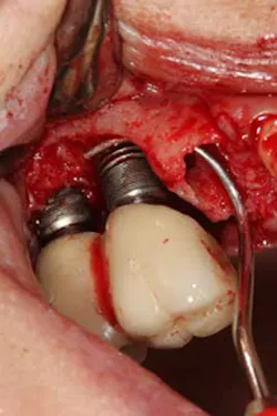 16apr21piafroum02 16apr21piafroum02