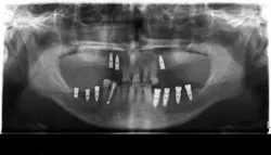 16jul28piahenderson01 16jul28piahenderson01