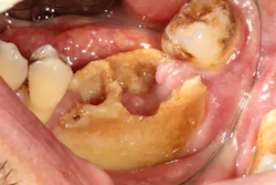 16sept15piadipace P01 16sept15piadipace P01