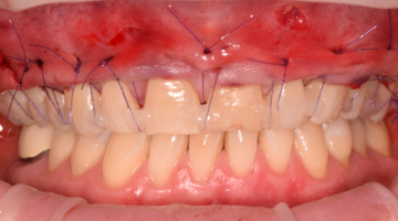 Content Dam Sr Online Articles 2017 04 17apr13piagumdrop Thumb