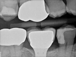 17jun8piaford P02 17jun8piaford P02