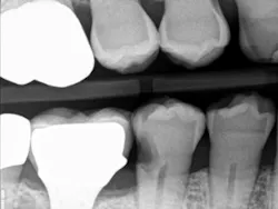 17jun8piaford P03 17jun8piaford P03