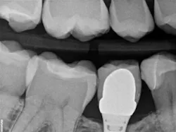 17jun8piaford P04 17jun8piaford P04