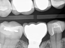 17jun8piaford P06 17jun8piaford P06