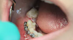 Content Dam Sr Online Articles 2017 08 17aug10piastrange Thumb Content Dam Sr Online Articles 2017 08 17aug10piastrange Thumb