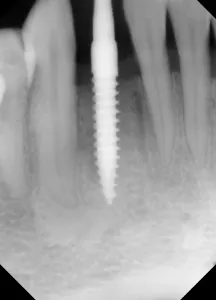 17sept14piamann P02 17sept14piamann P02