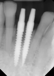 17sept14piamann P08 17sept14piamann P08