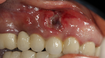 Content Dam Sr Online Articles 2018 01 18jan11piachiapascot