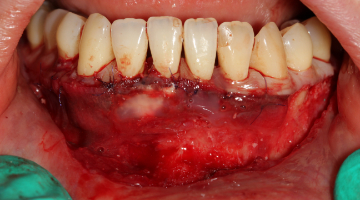 Content Dam Sr Online Articles 2018 01 18jan11piaclintipthumb