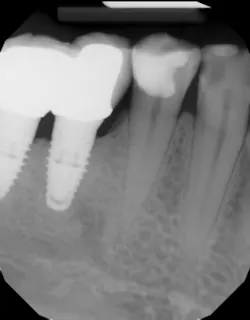 18may10piaclintip02 18may10piaclintip02