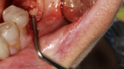 Content Dam Sr Online Articles 2018 06 18jun14piaclintipt