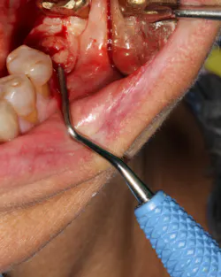 18jun14piaclintip02 18jun14piaclintip02