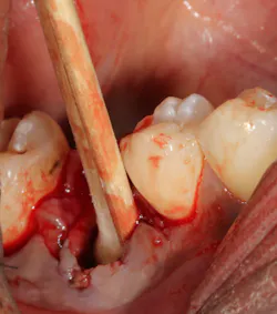 18jun14piaclintip03 18jun14piaclintip03