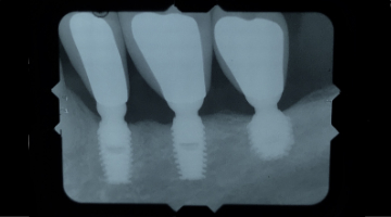 Content Dam Sr Online Articles 2018 07 18jul12piaclintipt