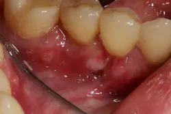 18aug9piaclintip02 18aug9piaclintip02