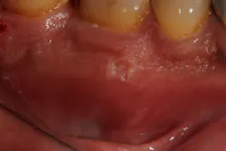 18aug9piaclintip05 18aug9piaclintip05