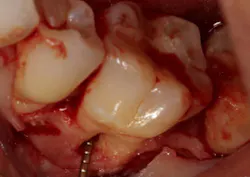 18oct11piaclintip01a 18oct11piaclintip01a