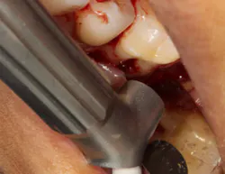 18oct11piaclintip02 18oct11piaclintip02