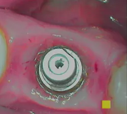 18nov8piawingrove01b 18nov8piawingrove01b