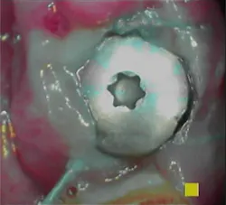 18nov8piawingrove01c 18nov8piawingrove01c