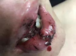 1903defro P01 1903defro P01