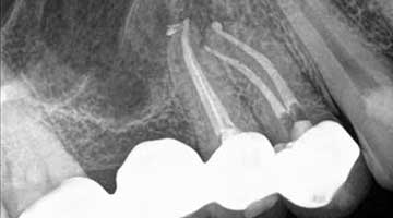 Content Dam Diq Online Articles 2015 11 Nonsurg Endo Cbct Mccormack Thumb