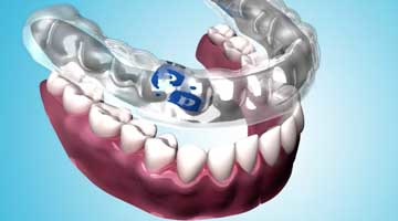 Content Dam Diq Online Articles 2015 12 Perioprotect Article Thumbnail