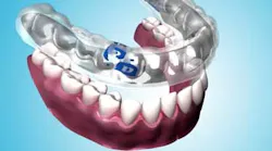 Content Dam Diq Online Articles 2015 12 Perioprotect Article Thumbnail Content Dam Diq Online Articles 2015 12 Perioprotect Article Thumbnail