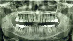 Content Dam Diq Online Articles 2016 02 16feb18piaheilweil Article Thumbnail Content Dam Diq Online Articles 2016 02 16feb18piaheilweil Article Thumbnail