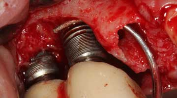 Content Dam Diq Online Articles 2016 04 16apr21piafroumt