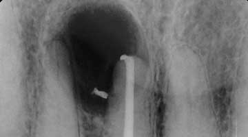 Content Dam Diq Online Articles 2016 05 16may19piafroumt