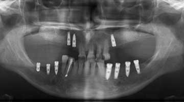 Content Dam Diq Online Articles 2016 07 16jul28piahendersont