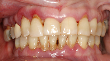 Content Dam Diq Online Articles 2016 11 16nov10pia Henderson T